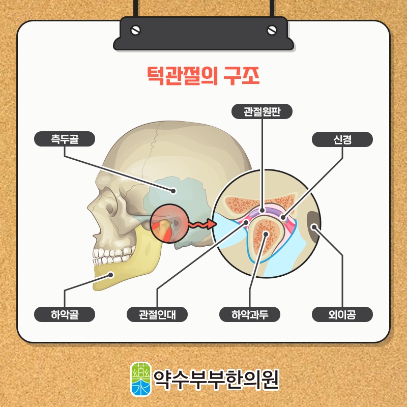 턱관절장애, 입을 벌릴 때 나는 소리의 원인 살펴보기