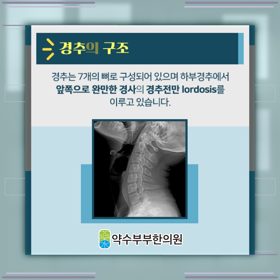 거북목증후군에서 사각근 단축을 막는 자세 관리