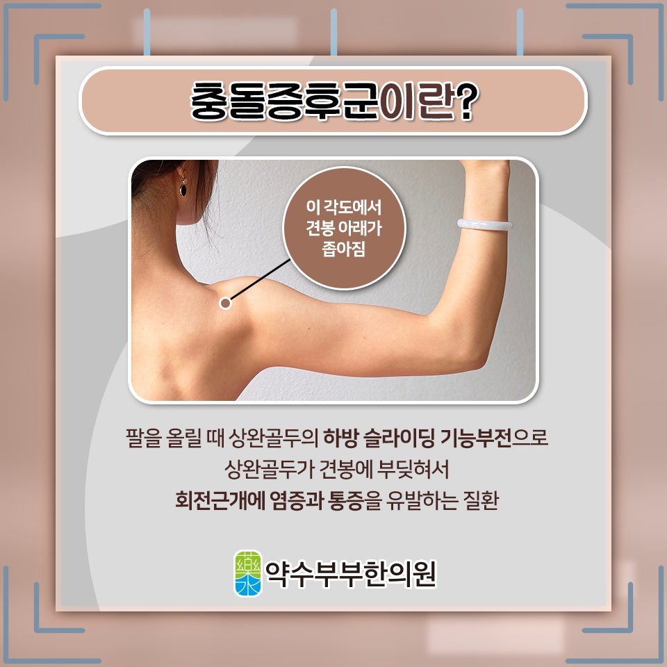 충돌증후군으로 누운 채 방향을 바꾸기 힘든 어깨 통증