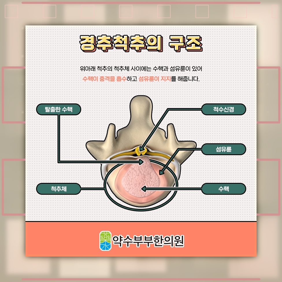 목디스크, 목 통증 외에 살펴볼 수 있는 증상들