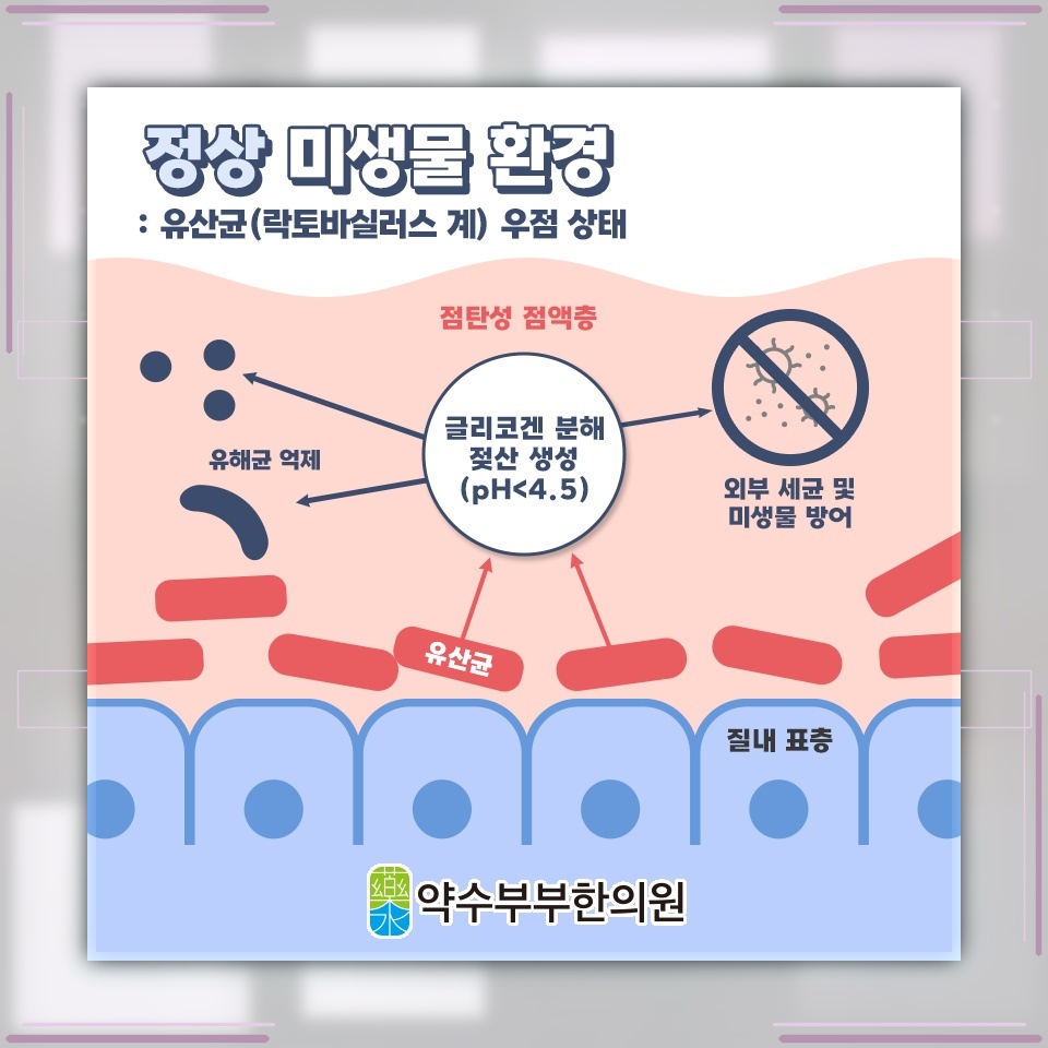 질염으로 불편해진 여성 건강 환경을 편안하게 관리하기