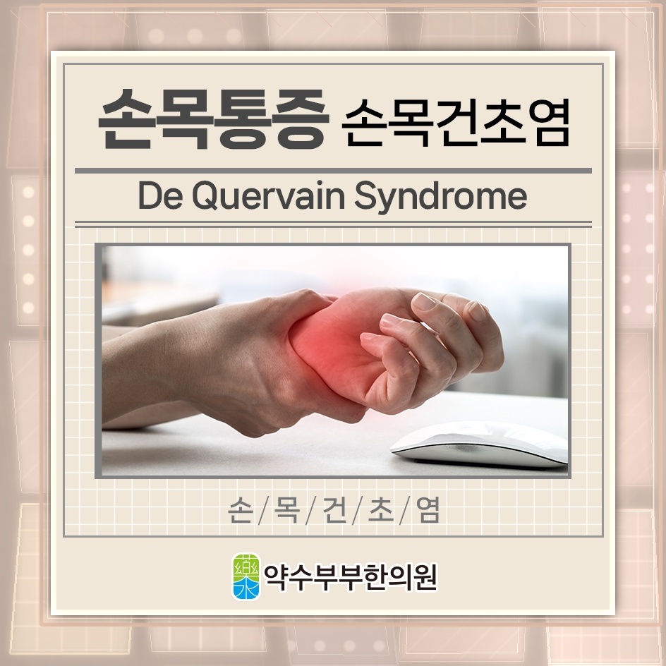 손목건초염으로 오래 지속되는 엄지손가락 통증