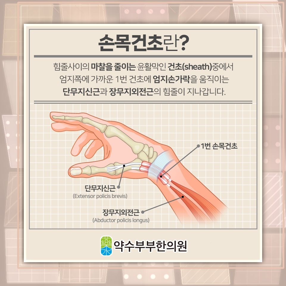 손목건초염으로 오래 지속되는 엄지손가락 통증