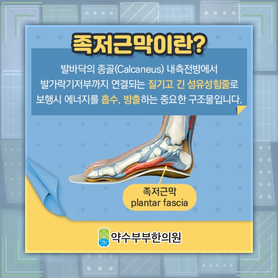 족저근막염, 아침 첫발에 심해지는 발바닥 통증 이해하기
